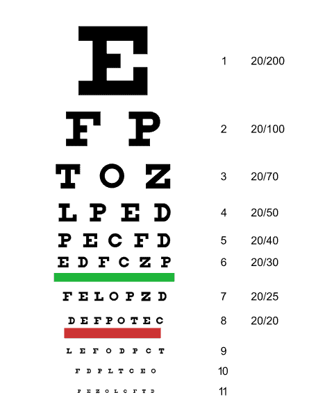 California DMV Vision Requirements CA DMV Vision Test Laser Eye Center