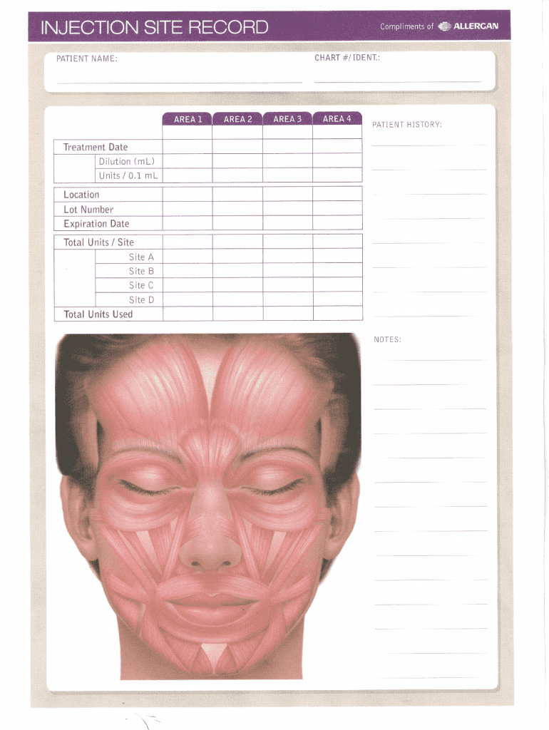 Free Printable Botox Face Chart Fill Out Sign Online DocHub