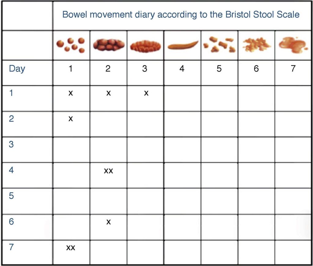 Printable Bristol Stool Chart