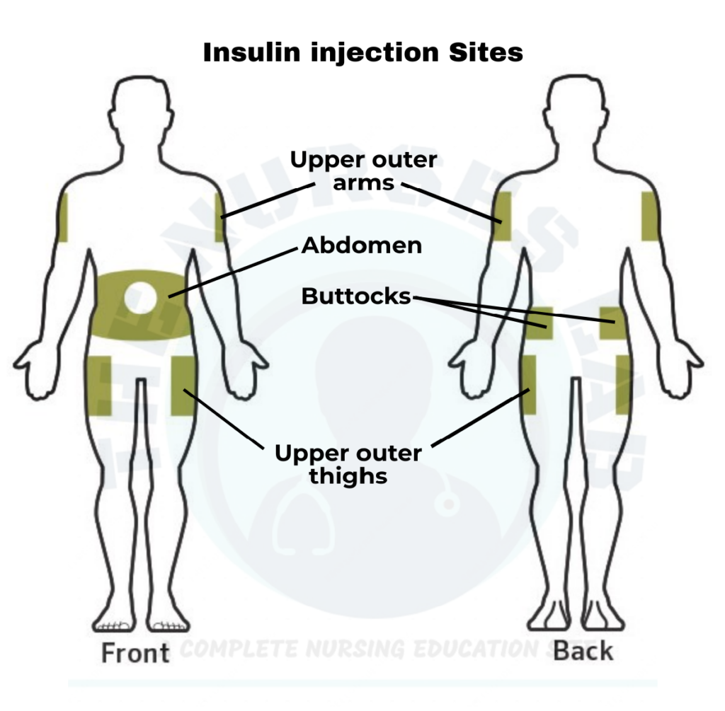 Printable Insulin Injection Site Rotation Chart