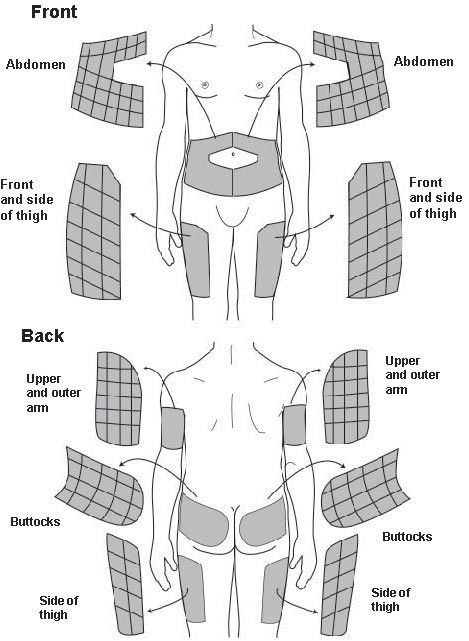 Printable Insulin Injection Site Rotation Chart